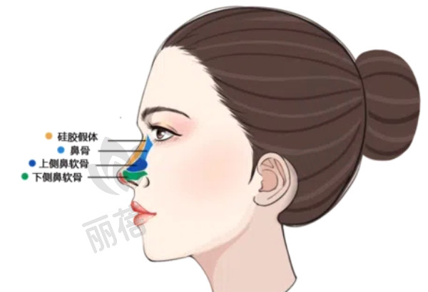 林勇医生隆鼻技术怎么样