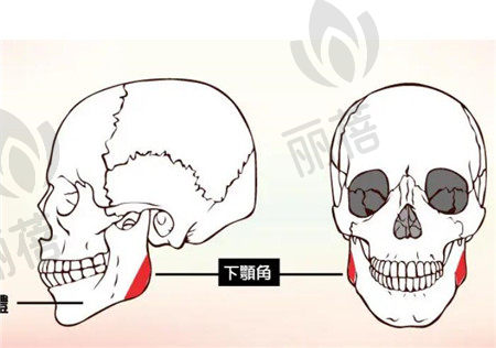 颧骨提升术有风险吗?会失败吗