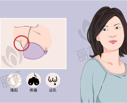 ：副乳切除手术有必要吗？副乳不去除会有哪些潜在风险？