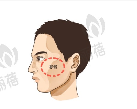 颧骨整形手术有副作用吗，失败应该怎么修复