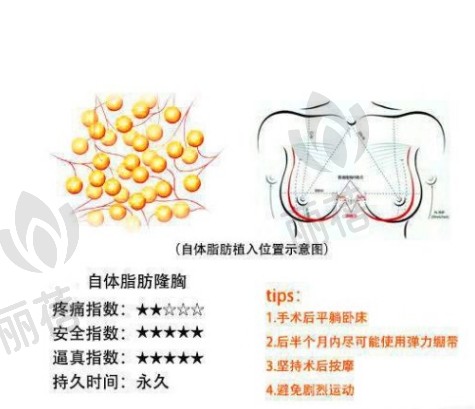 注射玻尿酸丰胸的整形效果能维持多久?