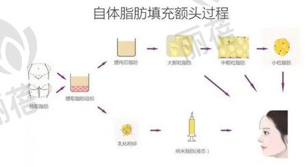 自体脂肪填充后多久可以使用护肤品?