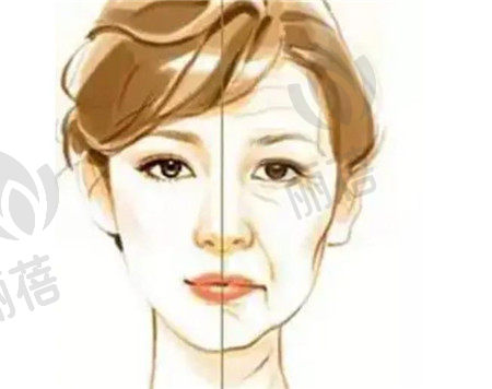消除眼角皱纹有几种方法