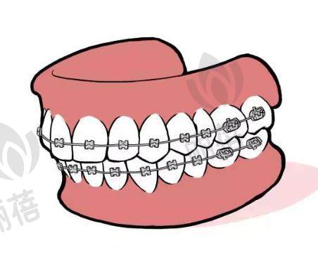 矫正牙齿后牙齿容易松动吗?