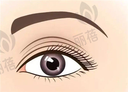 双眼皮手术的操作原理