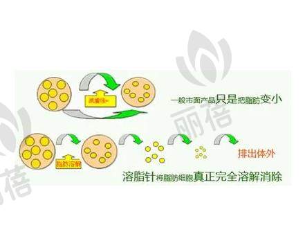 注射溶脂可以去眼袋吗，好处是什么