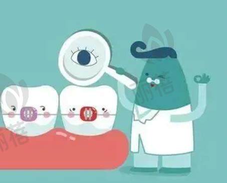 牙齿矫正的方法有哪些类型