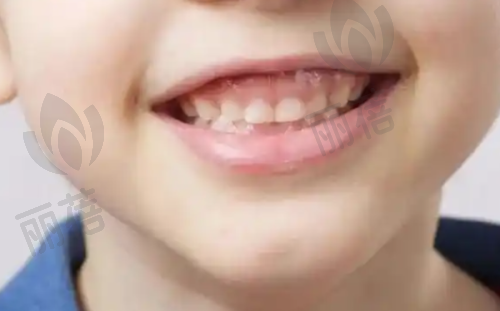 总结