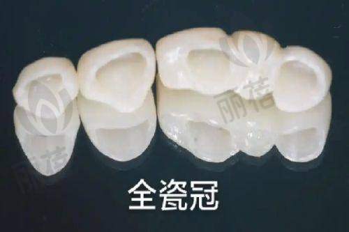 总结