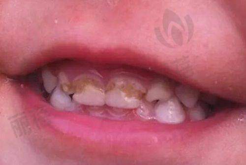 价格表:实惠的口腔项目
