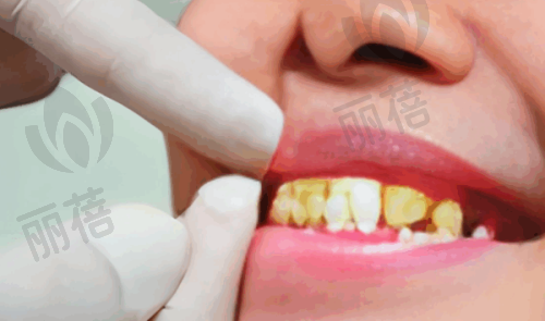 柳州中瑞口腔其他口腔项目情况