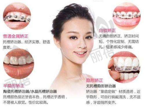 收费价格