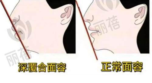 种植牙相关优势