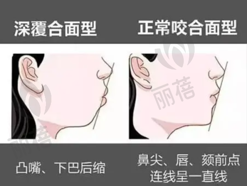 真实的患者实例分享