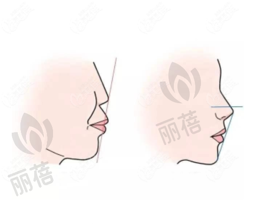 总结