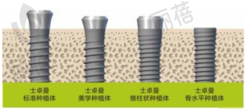 收费标准