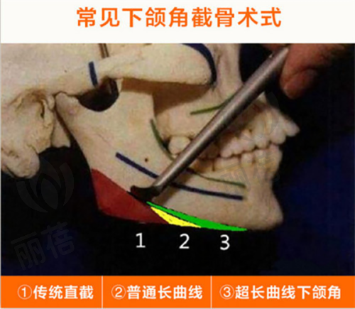 合肥福华医疗美容医生简介 - 朱纪磊医生