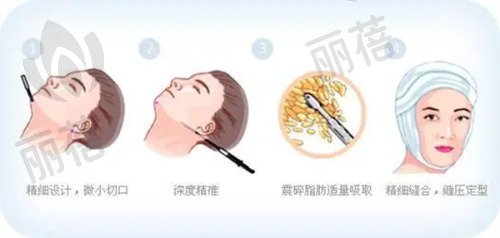 芜湖颜初医疗美容诊所合作动态