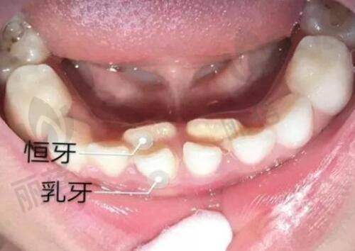 哈尔滨医 大医美医疗美容的优势
