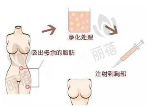 精良硬件支持,高端路线定位