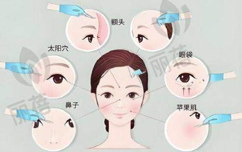 其他项目技术特色