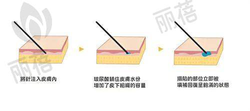 核心项目介绍
