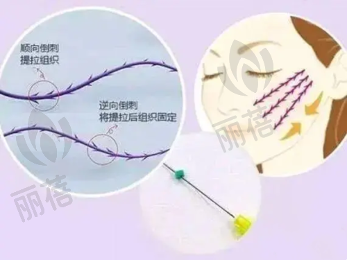 患者植发体验分享