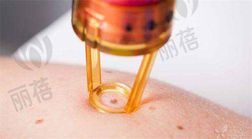 与其他植发医院的对比