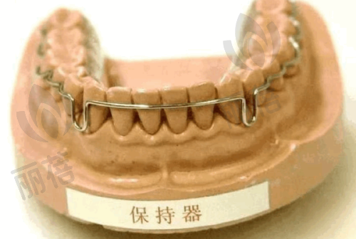 做烤瓷牙的相关知识