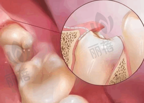 与周边其他口腔医院对比
