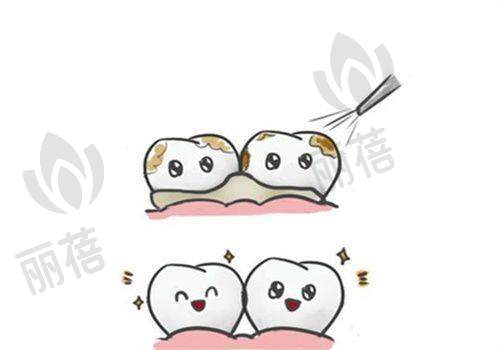 严格的消毒措施
